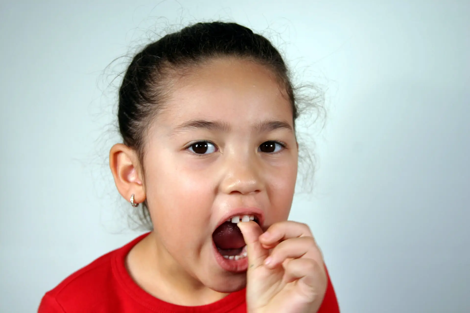 Child's Loose Tooth